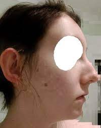 More images for ugly profile pictures » Ugly Side Profile How To Improve What Procedures Would Balance My Face 23 Years Old And Weigh 49kg Photos
