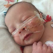 Sheila's craniotomy journey for her brain tumor diagnoses