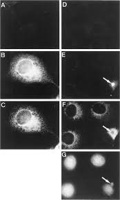 African swine fever (asf) is a devastating infectious disease of pigs, usually deadly. The African Swine Fever Virus Prenyltransferase Is An Integral Membrane Trans Geranylgeranyl Diphosphate Synthase Journal Of Biological Chemistry