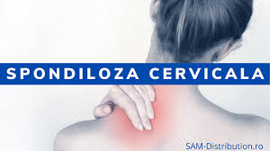 Menajarea si sustinerea portiunii de coloana afectata este, pe termen lung, o parte importanta a abordarii terapeutice in spondiloza. Spondiloza Cervicala Simptome Diagnostic Tratament Naturist
