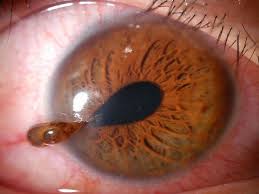 Image result for Cornea