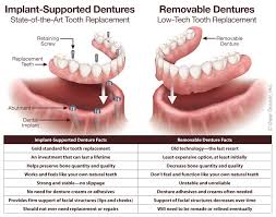 Image result for dentures