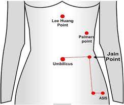 We were established in 1961 by claude n. A Retrospective Study Of A Novel Non Umbilical Laparoscopic Entry Port In Thin Patients Jain Point Gynecological Surgery Full Text