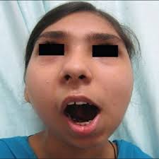 Siddharth Karanth's research works