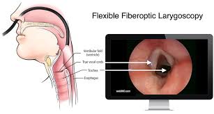 Image result for Reflux Laryngitis