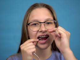 What to Know About Adolescent Oral Health Care and Orthodontics