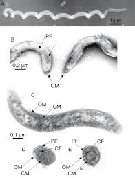 Image result for Treponema