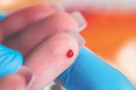Image result for Venous Blood Sampling