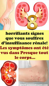 Pin On Sante Bien Etre