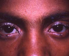 Image result for Blepharis involucrata