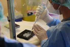 Bir çeşit in vitro klonlama olarak da tanımlanan pcr; Pcr Testi Nedir Pcr Testi Zorunlu Mu Ucretli Mi