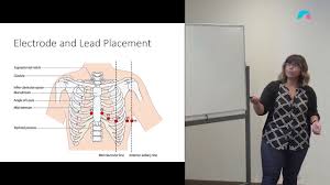 12 lead ecg placement