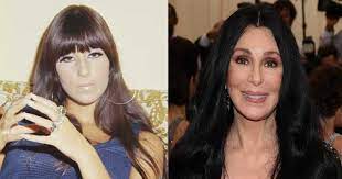 Learn about the ten most frequently performed cosmetic surgeries in the united states. Cher Plastic Surgery Disasters Purple Clover