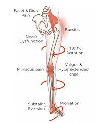 A hyperextension of the knee is when the knee is pushed too far back there's a number of warm up and cool down exercises that can be performed to help with the effects of a hyperextended knee. Do It Yourself Exercises To Beat Knee Pain Regenexx Tampa Bay