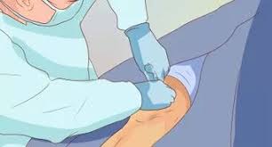 Why is my knee locking up? How To Unlock Your Knees 12 Steps With Pictures Wikihow