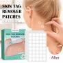 120 PCs/ box warts remover patch safe painless skin tags treatment wart fast action moles natural ingredients for all from www.carousell.sg