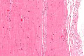 Transmission electron microscopes an overview. Tendon Wikipedia