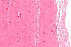 Collagen bundles that are generally tight and parallel instead look disorganised and discontinuous. Tendon Wikipedia