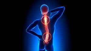 Hérnia de Disco Lombar (CID M54) Ocupacional, Entenda Tudo Sobre! -  PericialMed