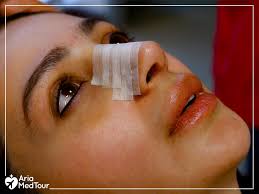 As far as whether you should replace them, i would be in contact with your surgeon's office as to the best care after they come off. Nose Tape After Rhinoplasty Should You Skip It Step By Step Guide