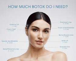 Botox Mt Pleasant & Charleston