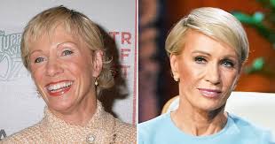 Barbara Corcoran Plastic Surgery: 2 Experts Reveal Possible Work