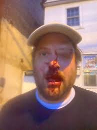 Dennis Leid's Instagram, Twitter & Facebook