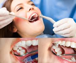 Repairing a chipped tooth as soon as it occurs guarantees your incident doesn't cause additional issues, however what are your alternatives? How Much Is A Filling At The Dentist Dental Filling Cost In Los Angeles Ca West Hollywood Holistic And Cosmetic Dental Care