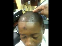 Read 19,077 reviews from the world's largest community for readers. Bad Hairline Before Youtube