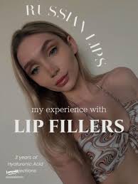 Essential Tips for First-Time Lip Filler Users