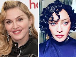 Maybe you would like to learn more about one of these? Podtyanula Veki I Udalila Zhir Iz Shek Eksperty Rasskazali Pochemu Madonna Perestala Pohodit Na Sebya