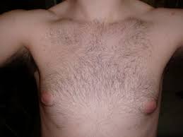 m/teen] Gynecomastia? Puffy nipples? Very insecure. :( : r/Fitness