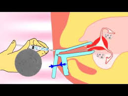 Home Insemination Kit Never From Jazzy573 On Ebay Com Youtube