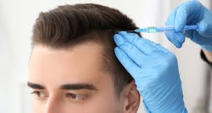 What is a hair graft. This Is Who S A Good Candidate For Fue Hair Transplantation Surgery