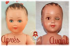 RESTAURATION DES YEUX D'UN BAIGNEUR SNF