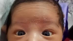 Bayi baru lahir memang membutuhkan perhatian ekstra di setiap apapun yang terjadi padanya. Wajah Bayi Beruntusan Seperti Ini Apa Sebabnya Ya