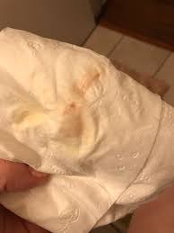 How do you confirm a miscarriage at home? Implantation Bleeding Miscarriage Start December 2019 Babies Forums What To Expect