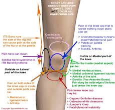 In this article we describe the hip and thigh muscles. Knee Pain Location Chart The Chelsea Knee Clinic