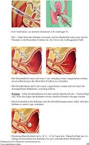 Ausfuhrliche Richtlinie Transurethraler Katheterismus Pdf Kostenfreier Download