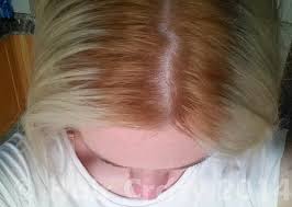 With each application of bleach, your hair is lifted three. Went To Have My Roots Bleached Stylist Turned My Hair Orange Forums Haircrazy Com