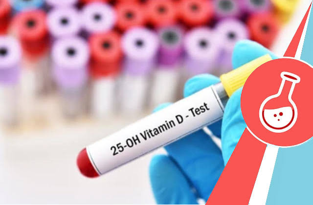 25-OH VITAMIN D (TOTAL) product image