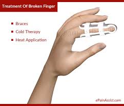 How long to recover from a broken finger? Broken Finger Treatment Causes Symptoms Signs