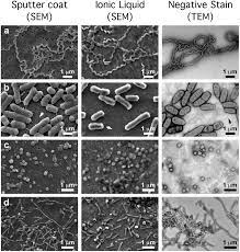 We did not find results for: The Scanning Electron Microscope In Microbiology And Diagnosis Of Infectious Disease Scientific Reports