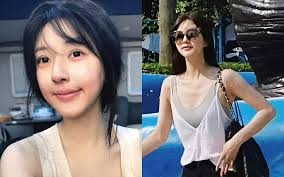 Ảnh Triệu Lộ Tư tiều tụy, chỉ còn da bọc xương được lan truyền gây sốc