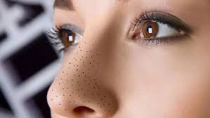 Cara menggunakan bengkoang untuk menghilangkan. 15 Cara Semulajadi Hilangkan Jerawat Blackhead Dan Whitehead Dengan Cepat
