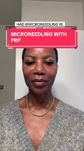 #blackesthetician #skincaretiktok #blackwomenover40 #blackwomenoftiktok  #blackwomenover50