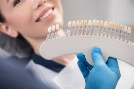Find the lowest price for veneers teeth price today! Are Veneers Worth It 5 Things You Should Know Before Getting Veneers Silver Smile Dental