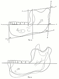 Er war etwa einen meter groß, sein gehirn hatte die größe einer. The Project Gutenberg Ebook Of Der Unterkiefer Des Homo Heidelbergensis By Otto Schoetensack