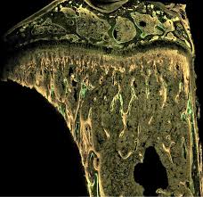 Related searches for cross section diagram copulation human cross section anatomyct cross section anatomyhuman anatomy cross sectioncross sectional anatomy quizzescross section of human bodyanatomy online atlascross section of a hearthuman heart cross section. Researchers Link Breast Cancer And Bone Growth Cornell Chronicle