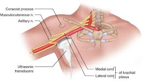 Image result for Axillary Nerve Block